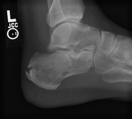 Case image 1