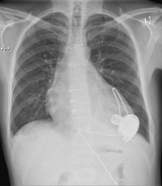 Case image 1