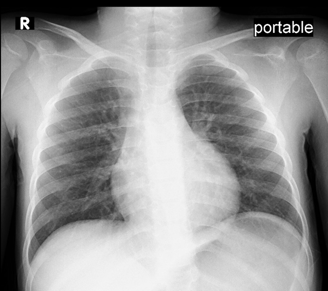 Case image 1