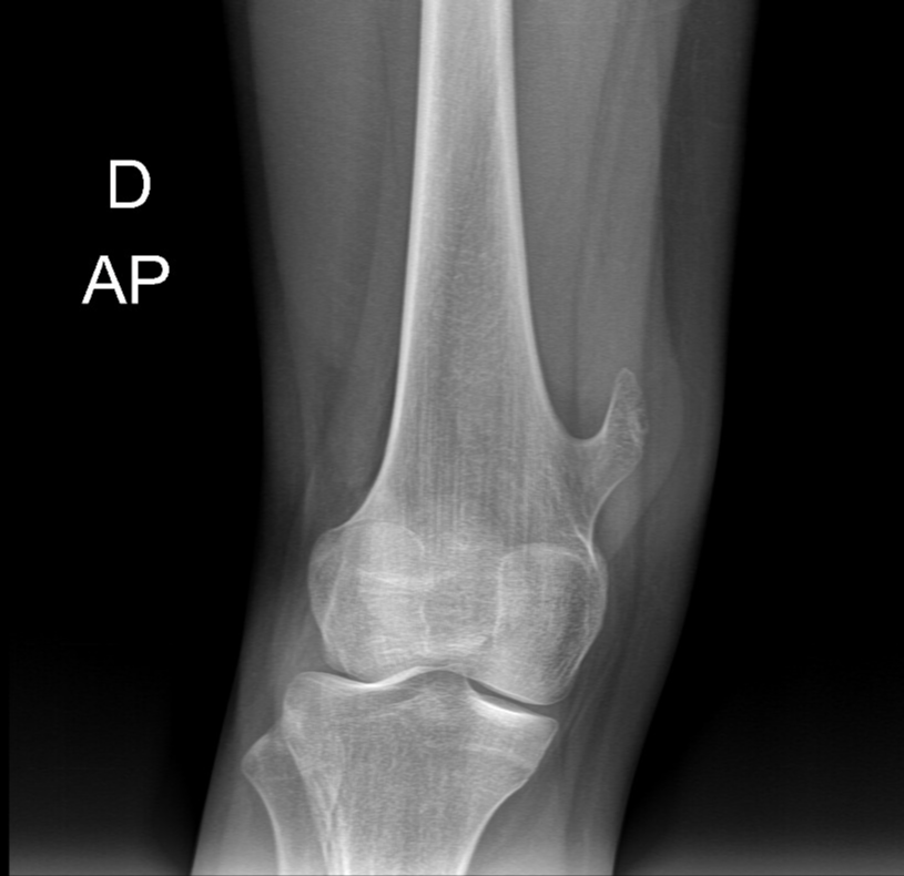Case image 1