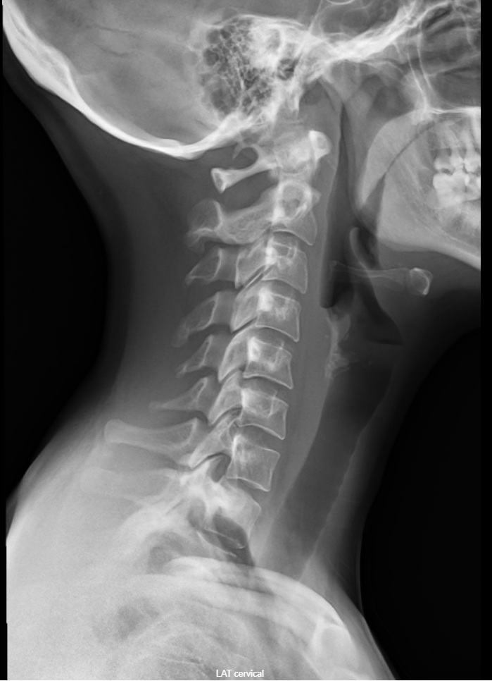 Case image 1