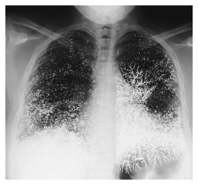 Case image 1
