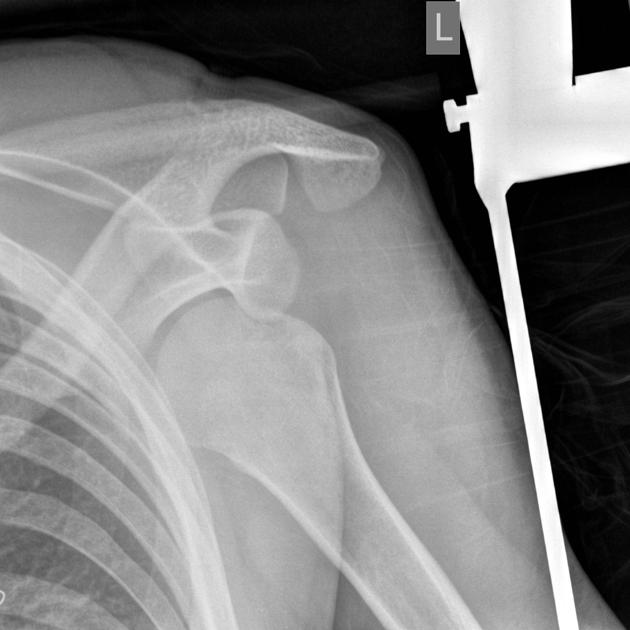 Case image 1