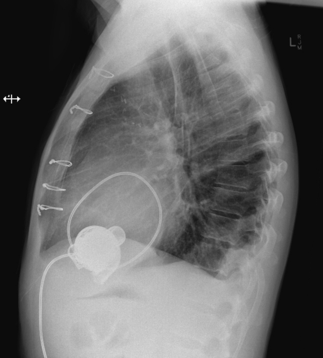 Case image 2