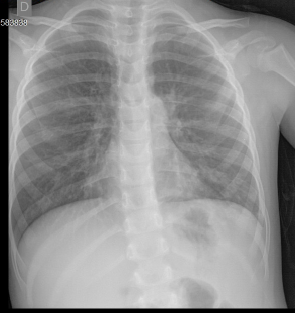 Case image 1