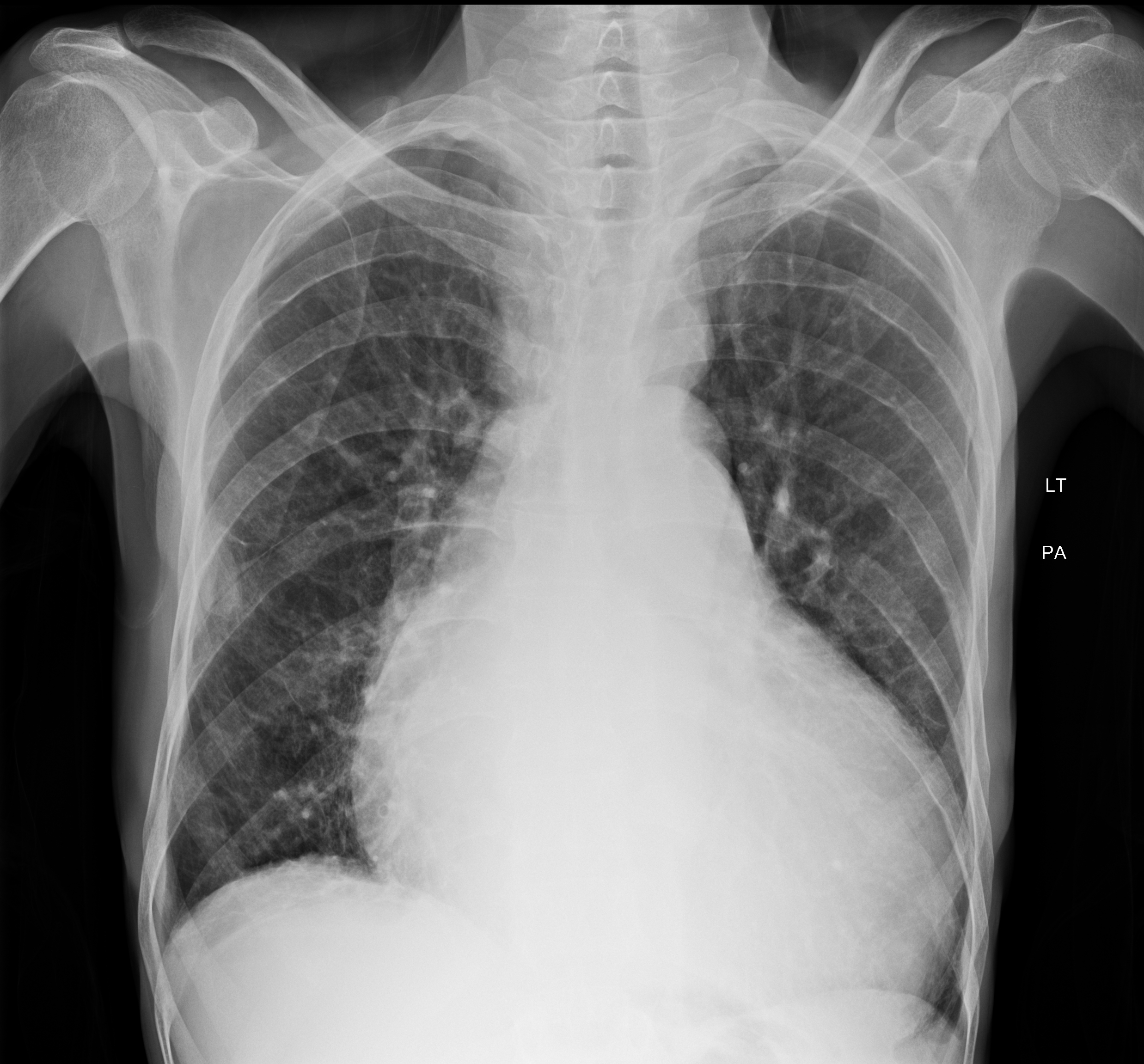Case image 1