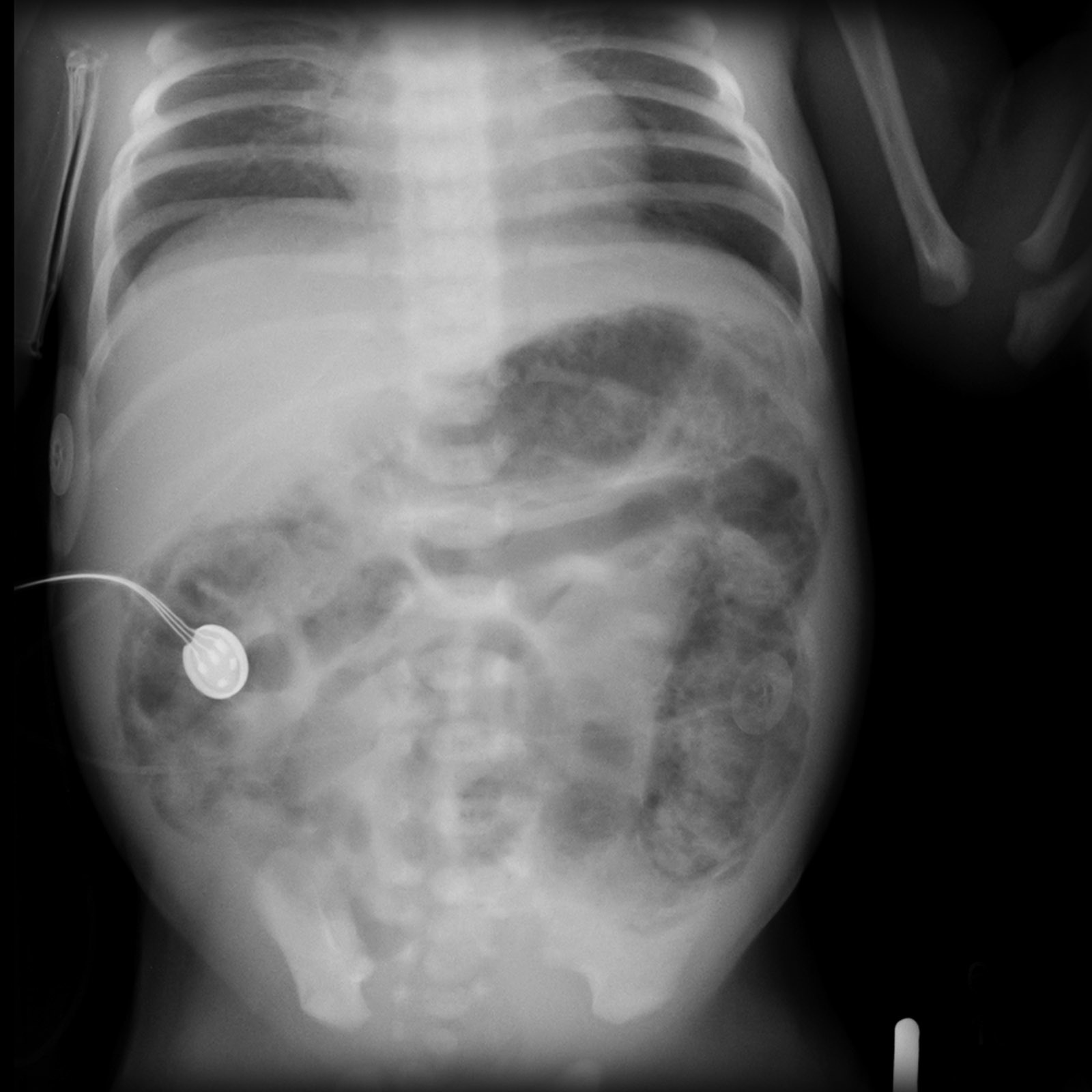 Case image 1