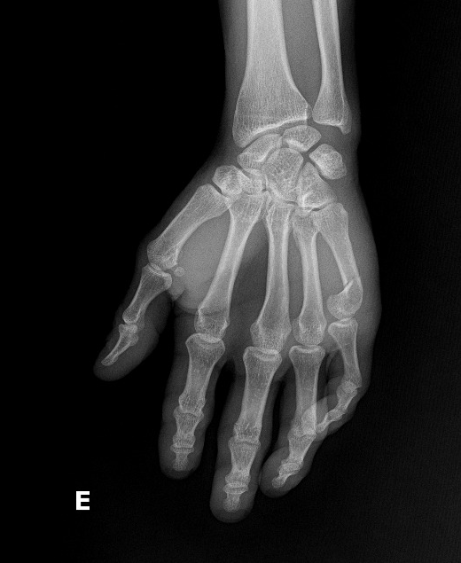 Case image 1