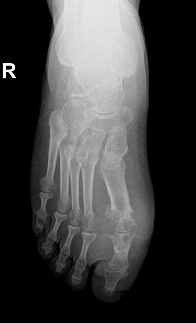Case image 1