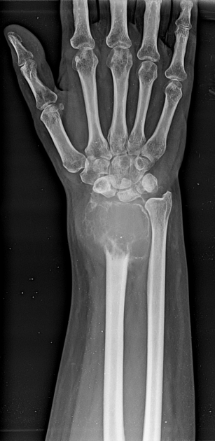 Case image 1