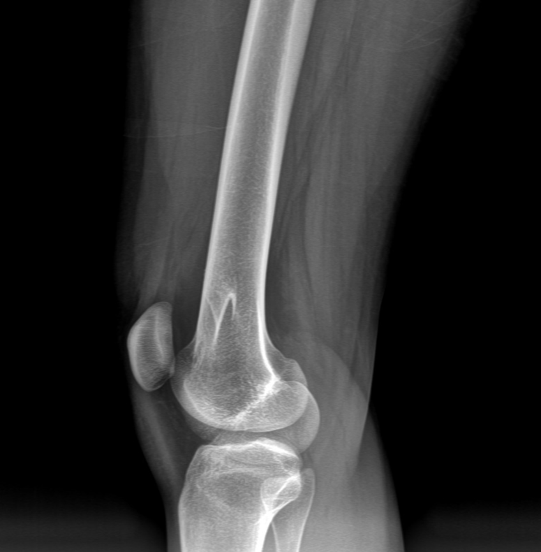 Case image 2