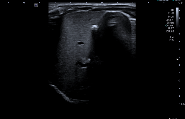 Case image 1