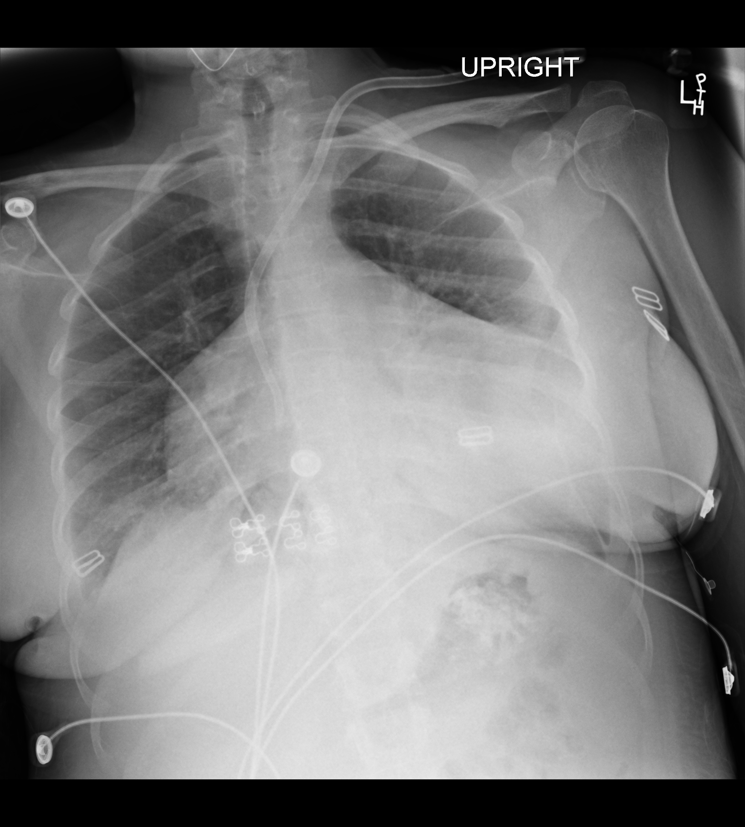 Case image 1