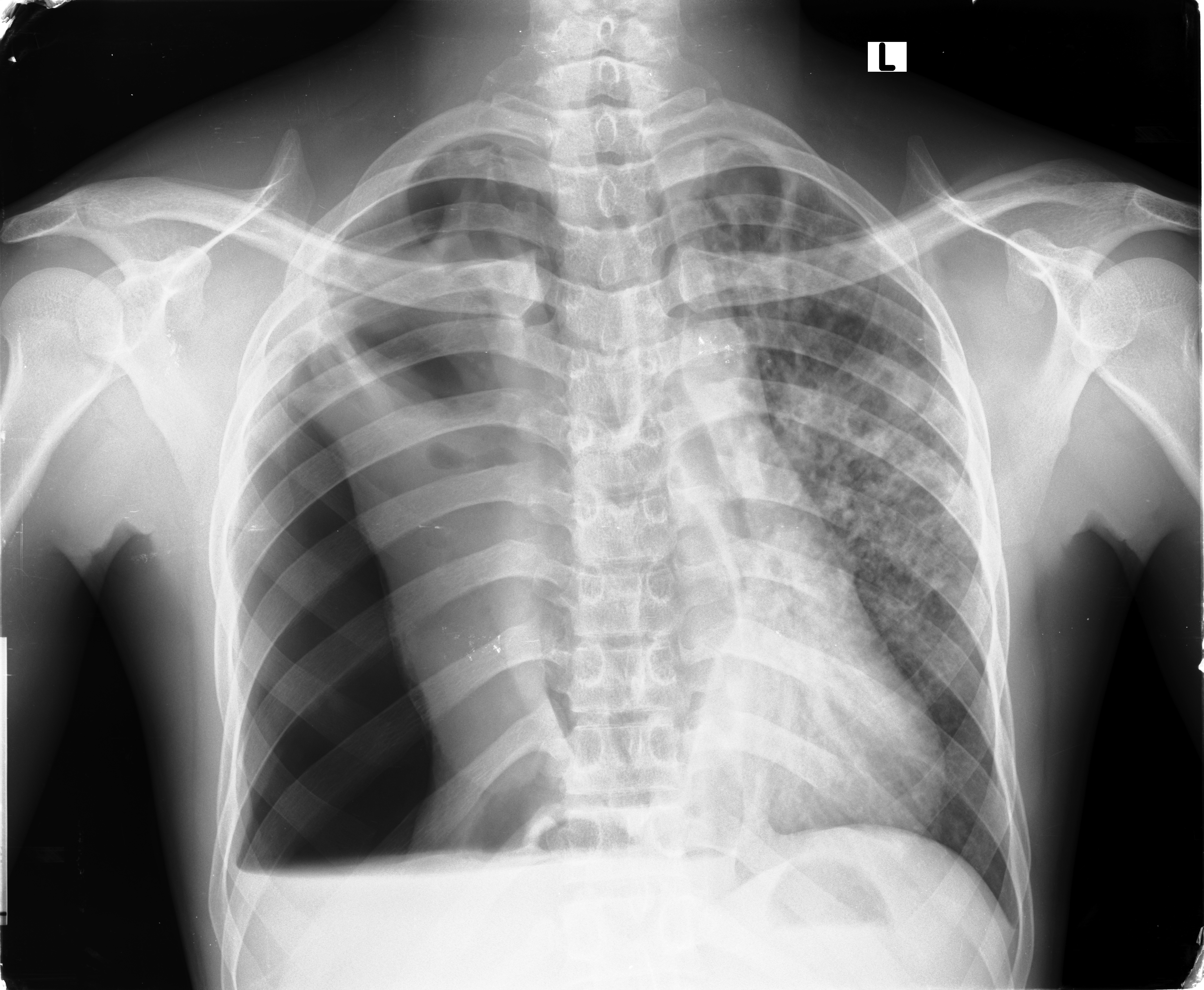 Case image 1