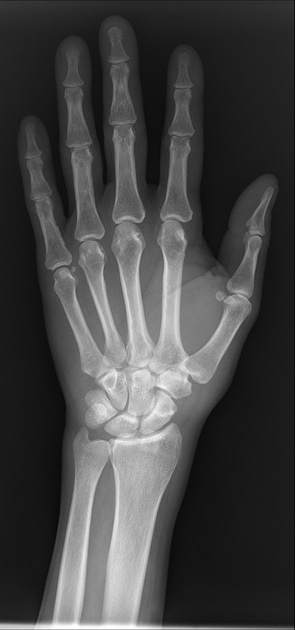 Case image 1