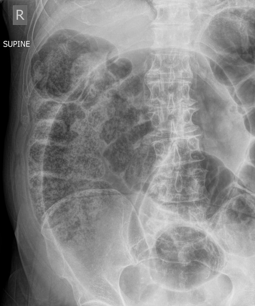 Case image 1
