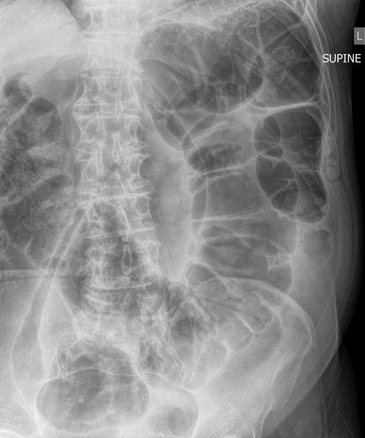 Case image 2